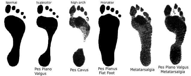 Original footprint comparison chart
